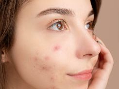 Learn about Pimples Inside the Nose